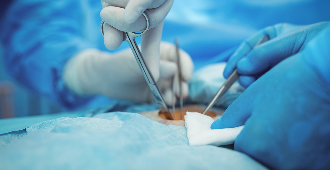 Recanalización tubaria